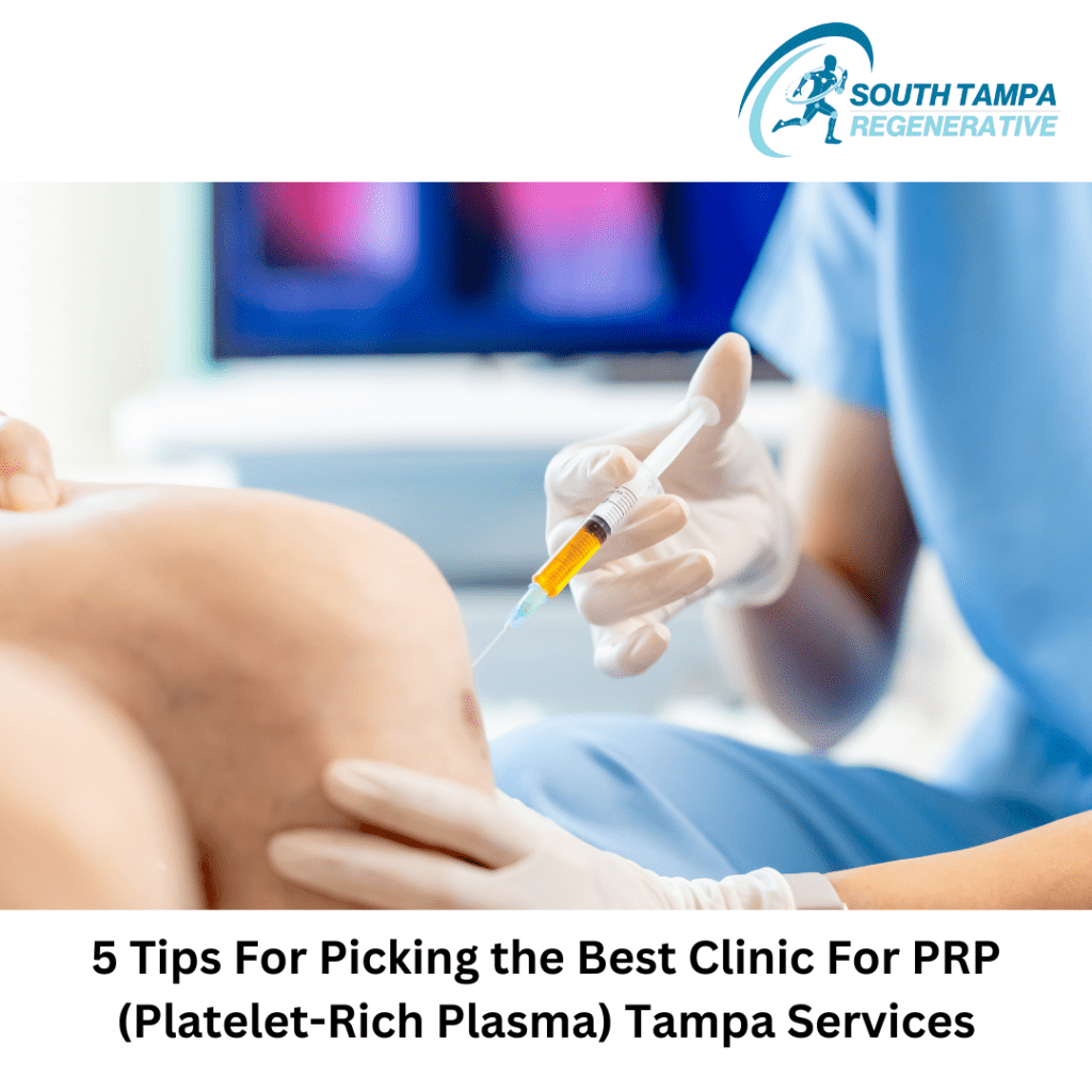 PRP Tampa